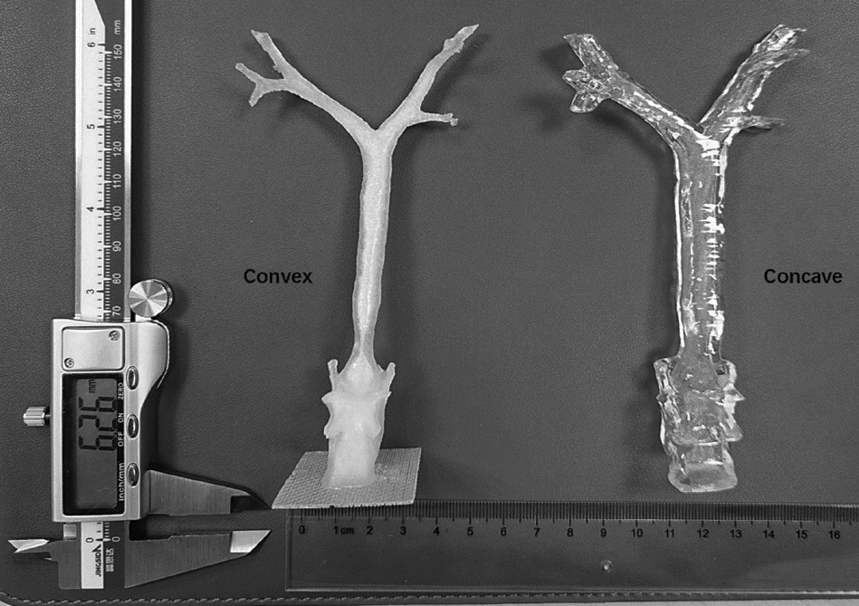 Convex and Concave Model 3D Printing for Designing Right-side Bronchial Blocker for Infants